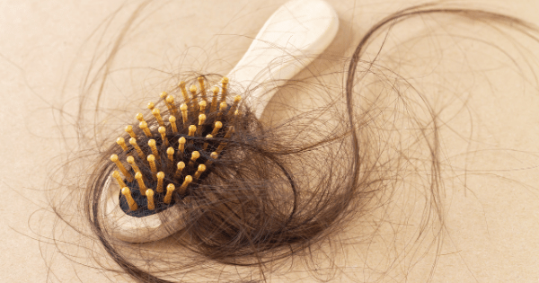 Expert Tips for Bangalorean Men on Preventing Hair Loss in Bangalore