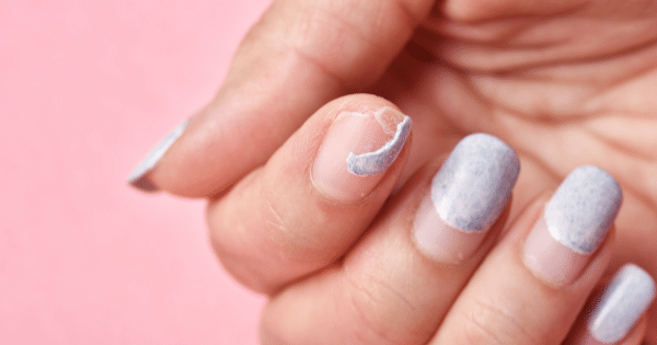 Most Effective Tactics To Strengthen Weak Nails in Bangalore