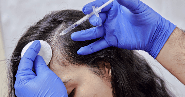 Decoding Hair Treatments in Koramangala: Local Knowledge and Pro Tips