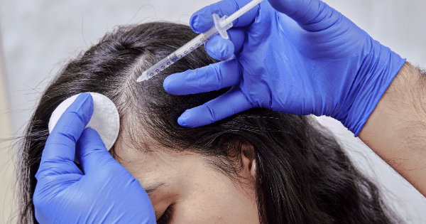 The Ultimate Beginner’s Guide to Hair Treatments in Koramangala