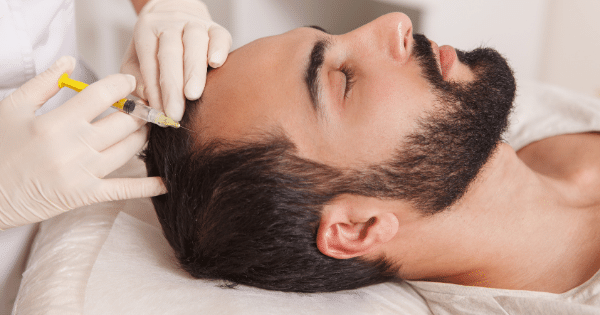 Men's Hair Care: Bangalore's Essentials for Treating Hair Loss