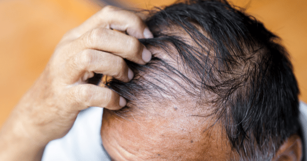 Men's Hair Care: Bangalore's Recommendations for Dealing with Oily Hair