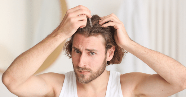 Men's Hair Care: Bangalore's Essentials for Dealing with Scalp Sensitivity