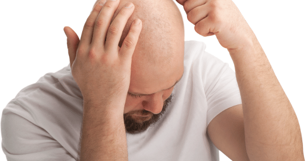 Men's Hair Care: Bangalore's Recommendations for Achieving the Perfect Bald Look