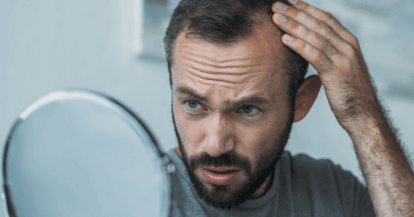 Men's Hair Care Challenges in Bangalore: Solutions and Strategies