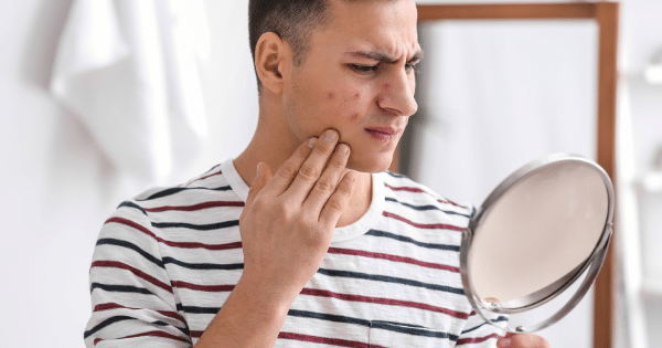 Overcoming Skincare Challenges Faced by Bangalorean Men